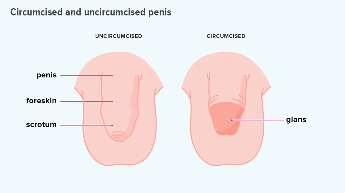 Circumcision Diagram